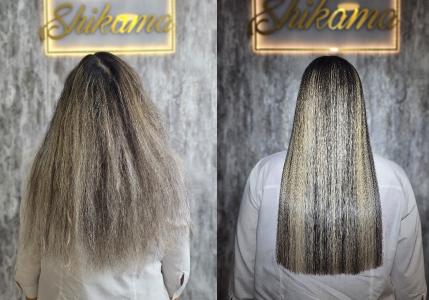 بهترین مرکز احیای مو در تهران کجاست؟