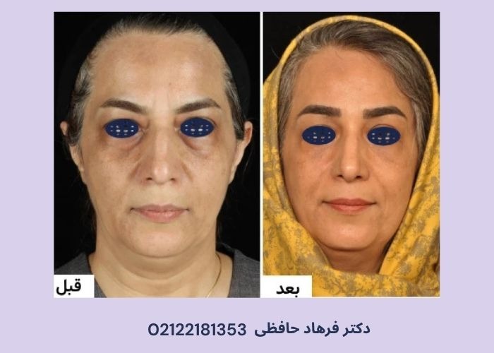 ۱۰ عادت روتین که صورت را خسته نشان میدهد